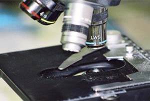 Анализ кала у собак Фото