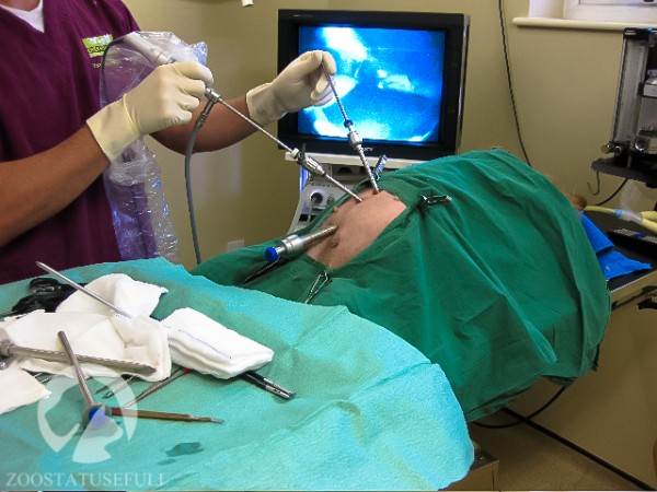 лапароскоп