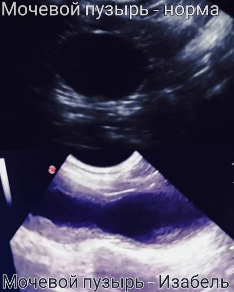 мифы об отжимании спинальников