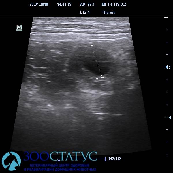 определение начала овуляции на УЗИ